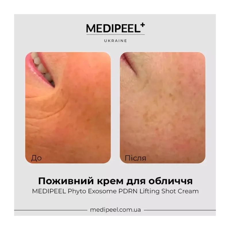 Антивіковий крем для обличчя Medi-Peel Phyto Exosome PDRN Lifting Shot , 50 ml